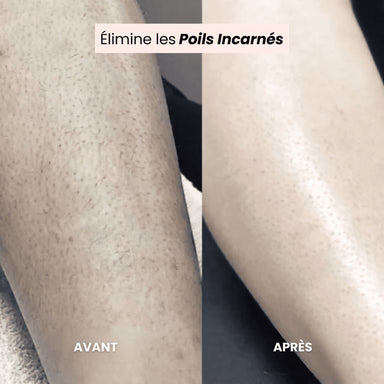 FreshSkin - Rasoir pour le visage et le corps