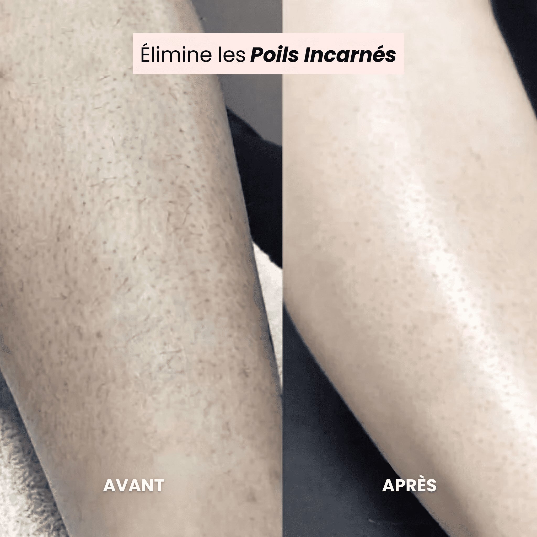 FreshSkin - Rasoir pour le visage et le corps