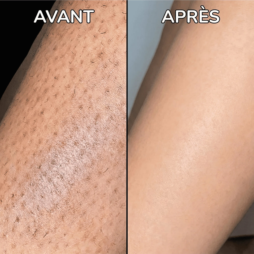 PureSkin - Sérum lissant anti-repousse